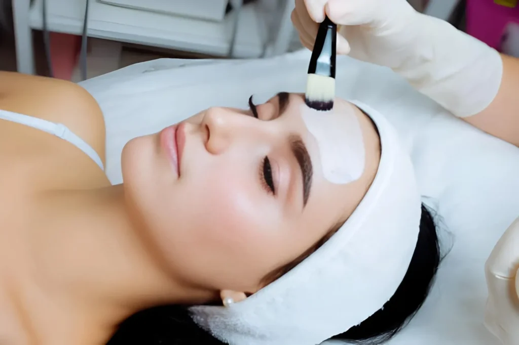 Chemical Peels